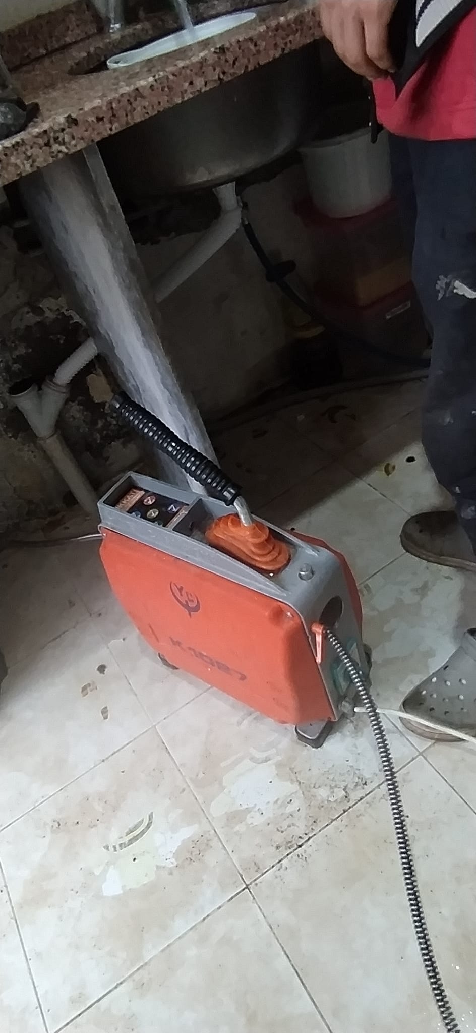 Ana Kolon Gider Açma